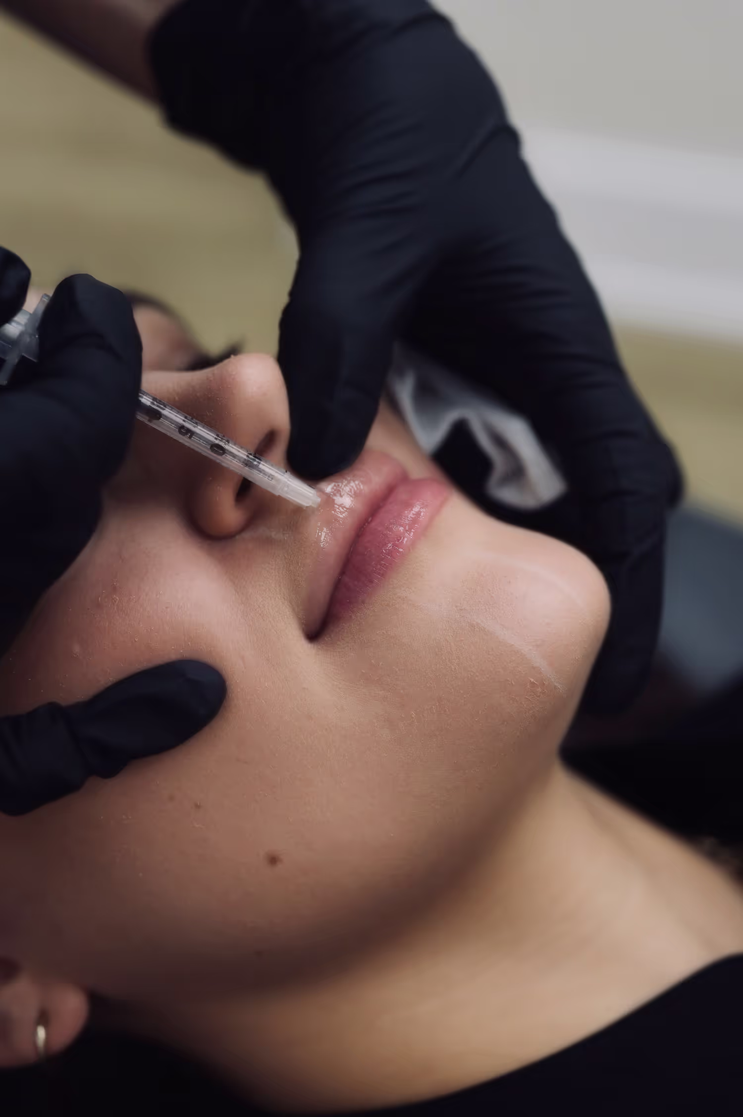 Dermal Fillers FAQs