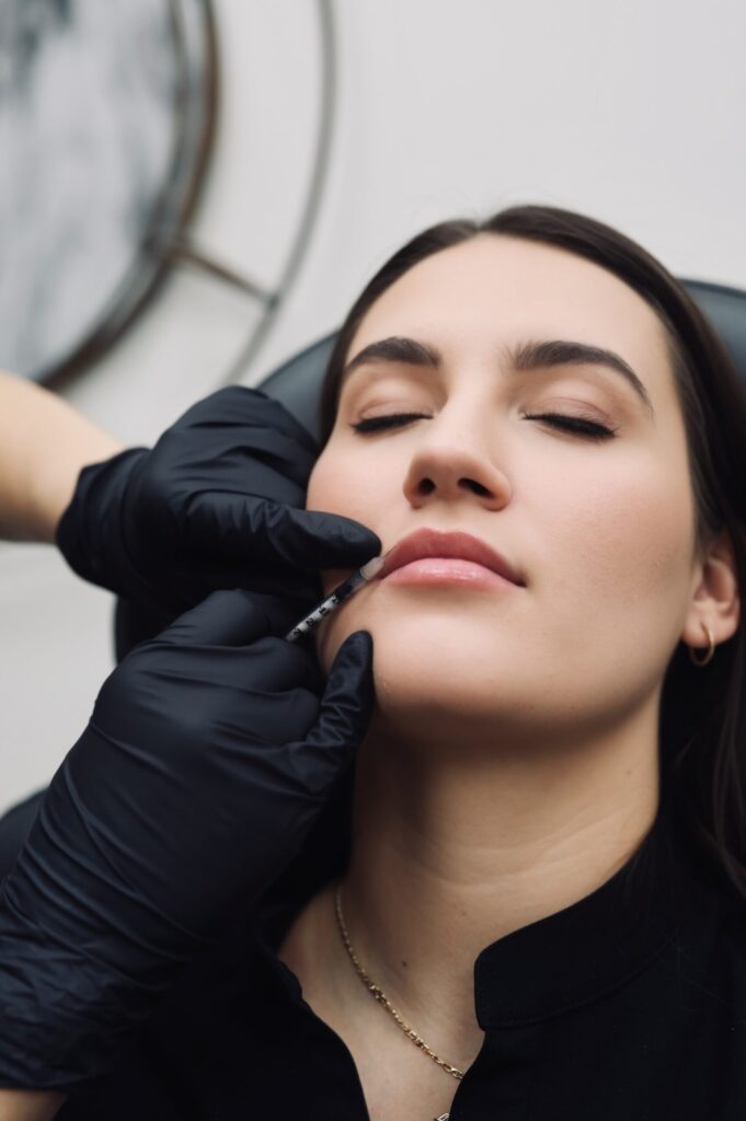 An injector treating a patient's lips with filler