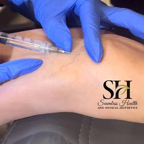 A gloved trainee practising a sclerotherapy injection on a leg