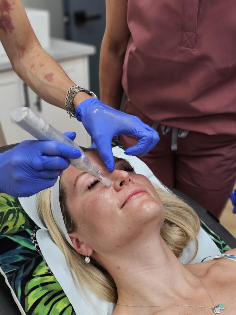 A trainee performing a PRP and microneedling treatment on a model