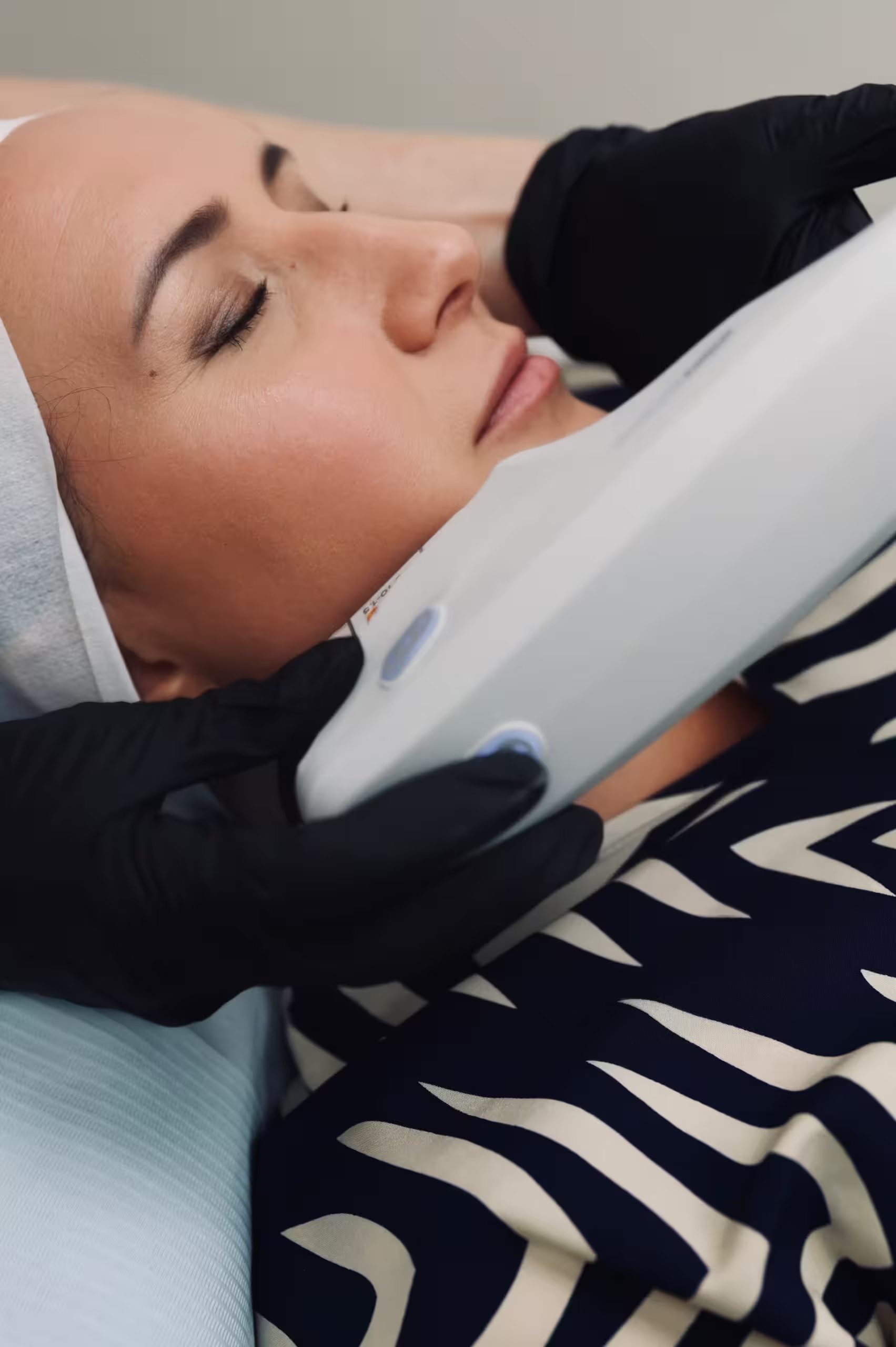 Ultherapy® Benefits: What You Should Know